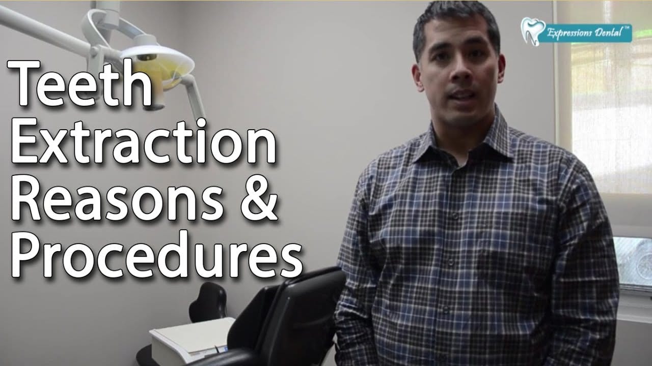 Read more about the article What is an Tooth Extraction and Who does it?