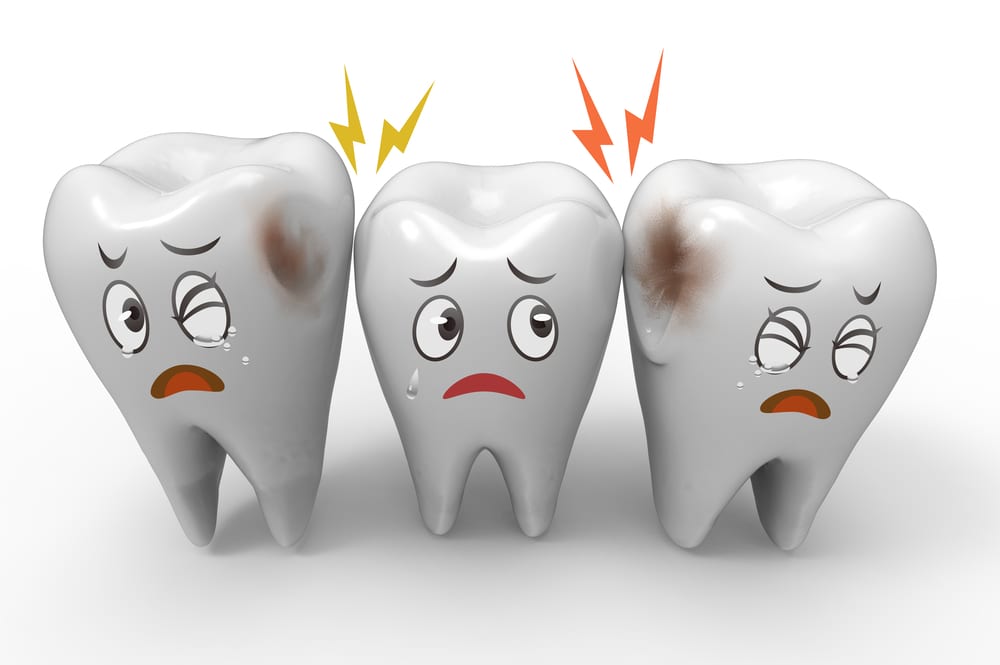 Read more about the article How Can I Prevent Cavities / Tooth Decay?