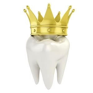 Read more about the article Taking Care of Temporary Dental Crown