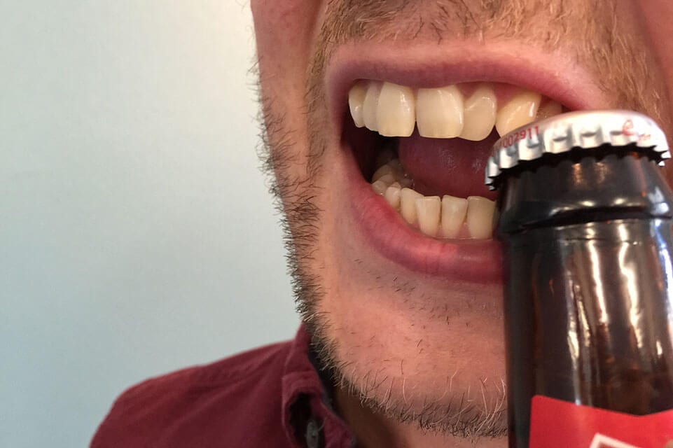 Read more about the article Bad Habits That Destroy Smile