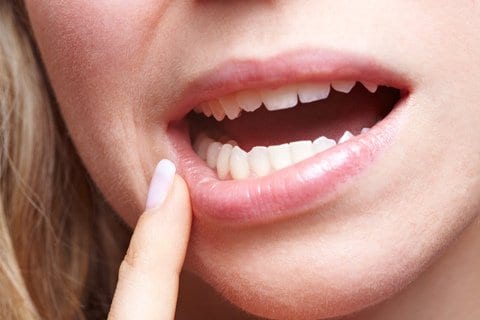 Read more about the article Oral Health Tips for Fighting Gingivitis