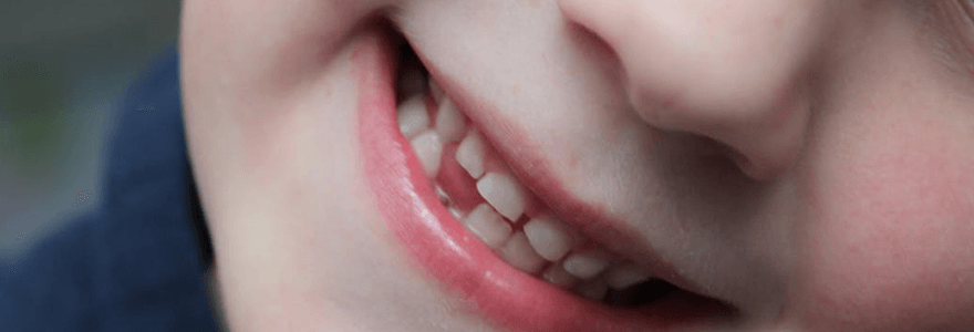 Read more about the article Reducing The Risk of Tooth Loss