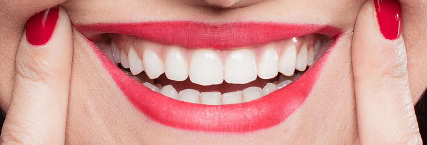 Read more about the article Difference Between Overbite and Underbite