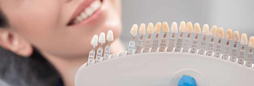 Read more about the article The Advantages & Disadvantages of Dental Veneers