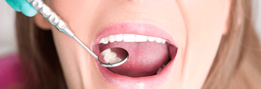 Read more about the article Tips to Reduce Tooth Sensitivity