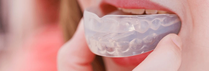 Read more about the article The Importance of Wearing a Custom-Fitted Mouth Guard