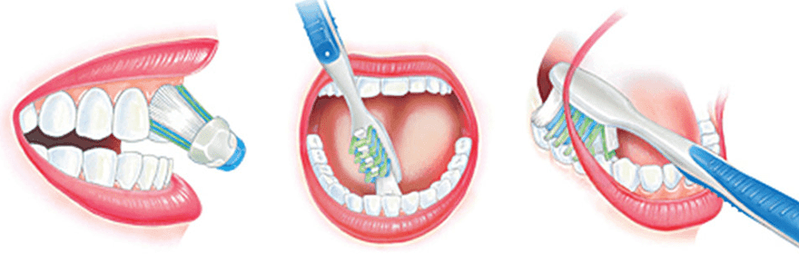 Read more about the article Five Oral Hygiene Practices You Might Be Doing Wrong