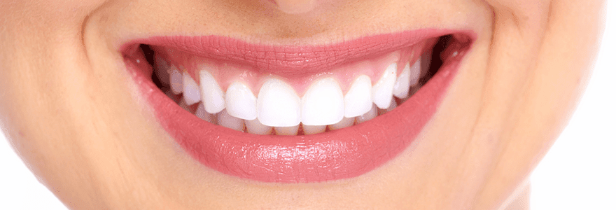 Read more about the article Restore Your Smile With Cosmetic Veneers