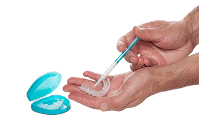 Take-Home-Teeth-Whitening-Trays-1
