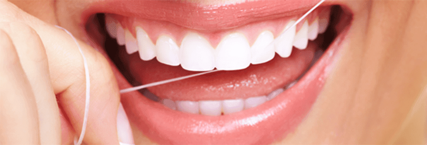Read more about the article Teeth Bonding for Gaps between Your Front Teeth