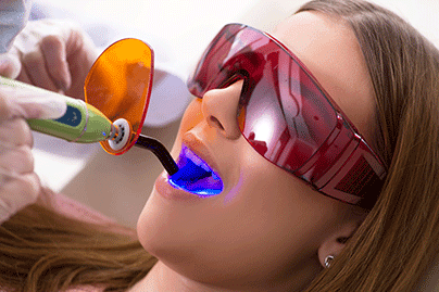 zoom-teeth-whitening-thumbnail-image (1)