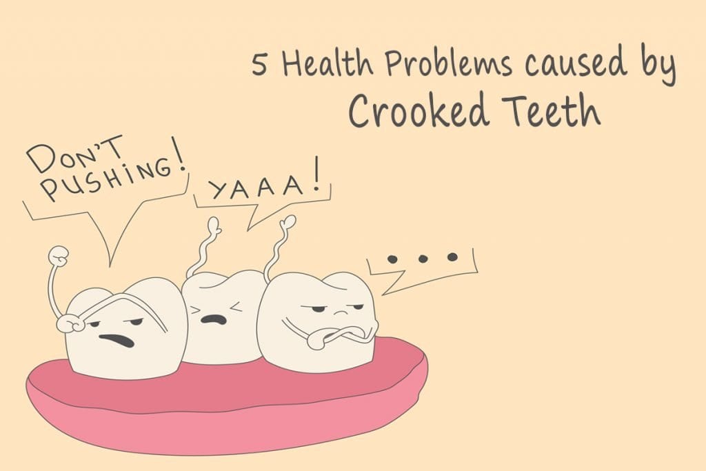 Crooked-Teeth-Treatment