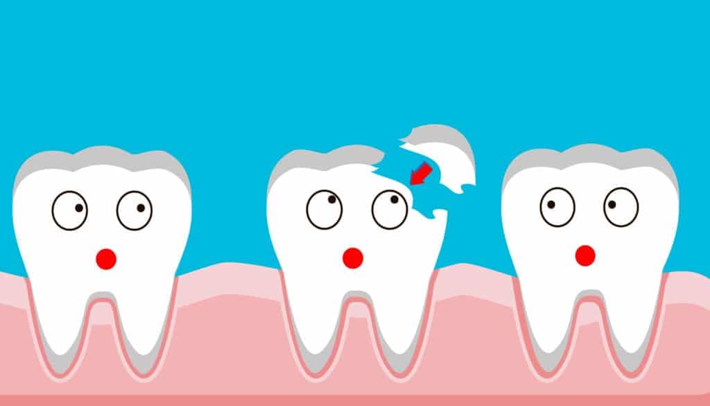 Read more about the article Chipped a Tooth? Here’s How Emergency Dental Care Can Help
