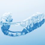 night-guard-for-bruxism
