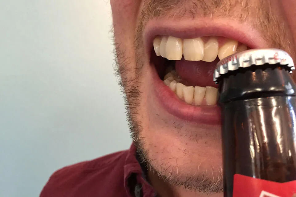You are currently viewing Bad Habits That Destroy Smile