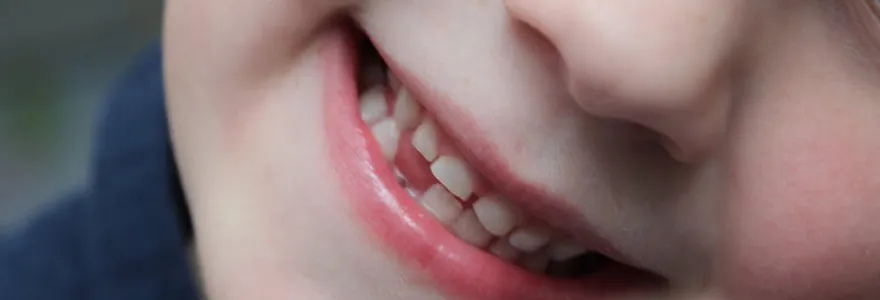 You are currently viewing Reducing The Risk of Tooth Loss