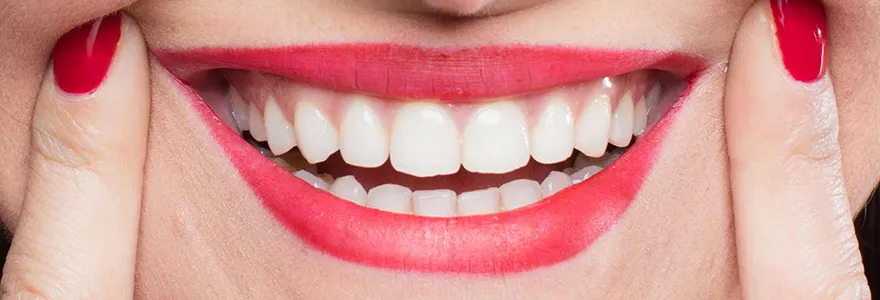 Read more about the article Difference Between Overbite and Underbite