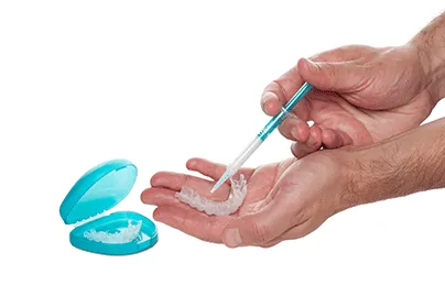 Dental Services 25 Take-Home-Teeth-Whitening-Trays-1