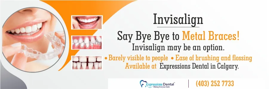Invisalign Braces