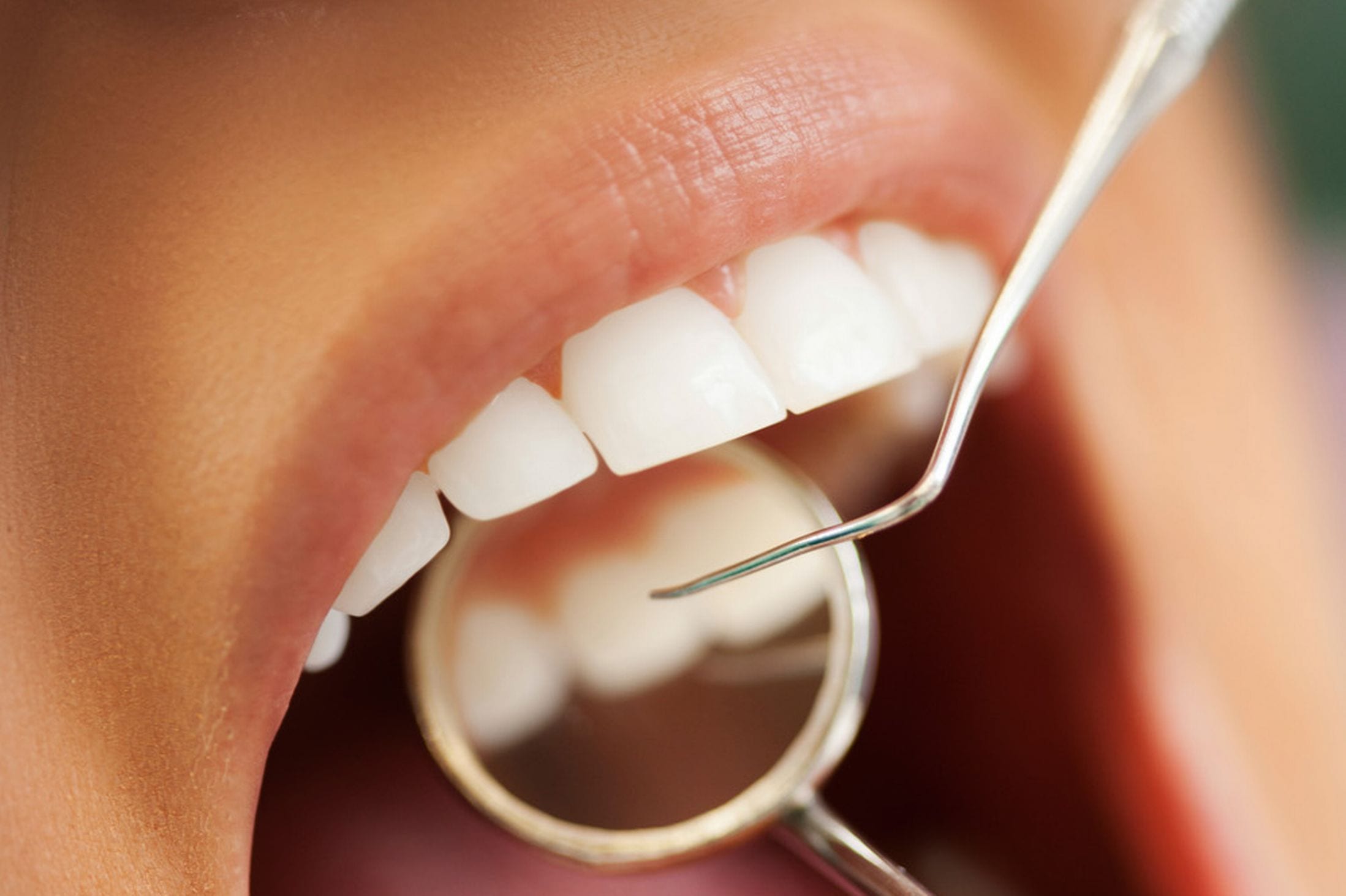 Read more about the article Beyond Teeth: What’s Inside Your Mouth?