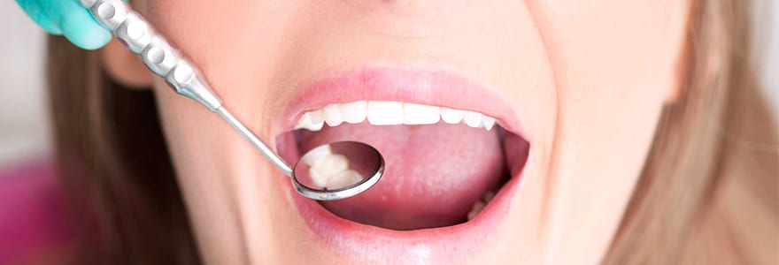 You are currently viewing Tips to Reduce Tooth Sensitivity