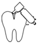 Emergency Dental Care 8 Emergency Root canal