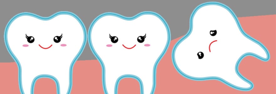 You are currently viewing How Many Wisdom Teeth Does a Person Have?