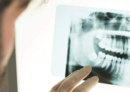 Digital-X-rays