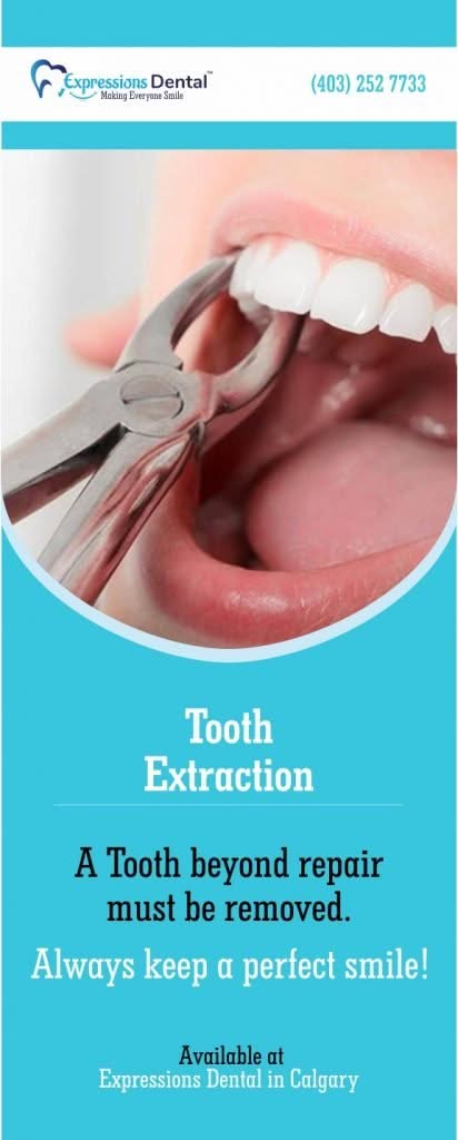 Thank You 9 Tooth Extraction