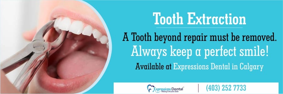 Thank You 3 Tooth Extraction